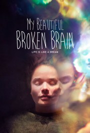 hd-My Beautiful Broken Brain