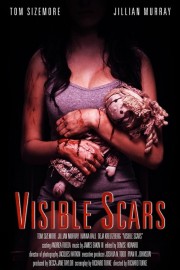 hd-Visible Scars